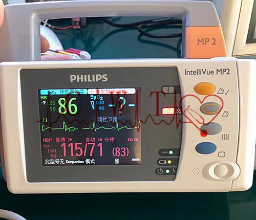 Philip MP2 ha usato il monitor paziente