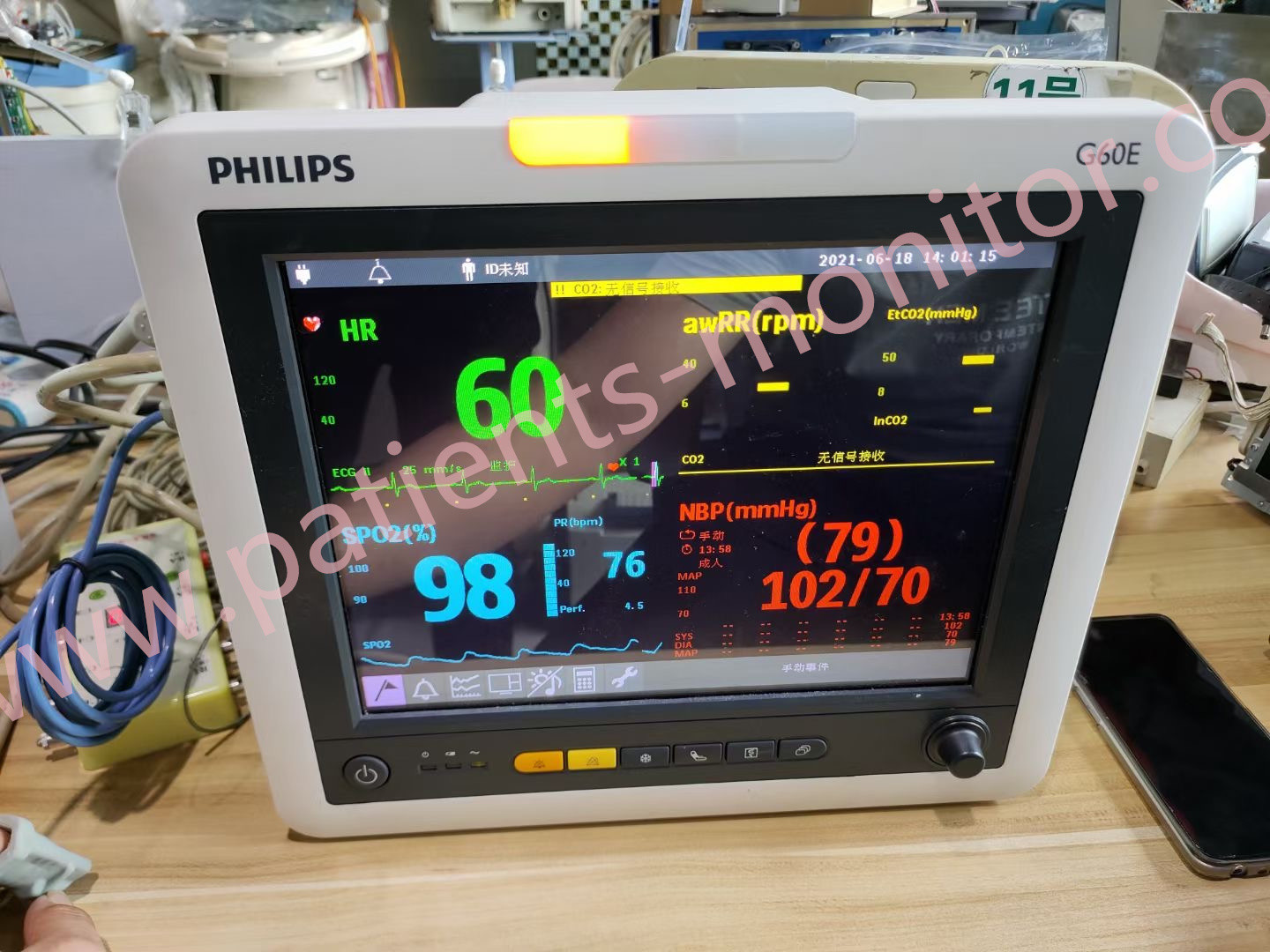 Monitor paziente di Philip G60E ICU per la clinica dell'ospedale